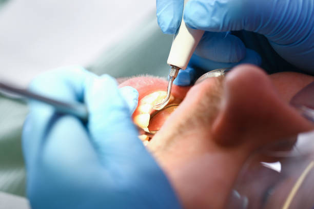 Best Emergency Treatment for Toothache in Tokeneke, CT