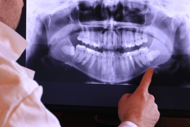 Best Emergency Broken Tooth Repair in Tokeneke, CT