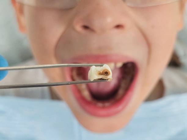 Best Emergency Dental Care for Trauma or Injury in Tokeneke, CT